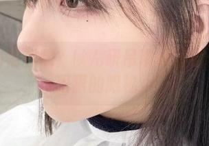 First Image